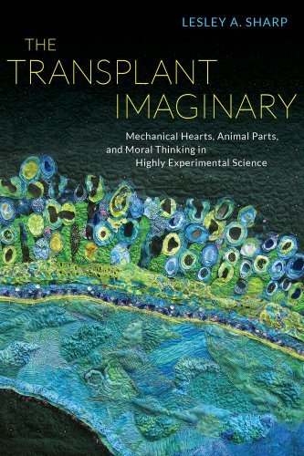 Lesley A. Sharp/The Transplant Imaginary@ Mechanical Hearts, Animal Parts, and Moral Thinki